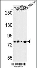 Anti-HOXB4 Rabbit Polyclonal Antibody