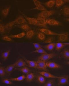 Immunofluorescence analysis of C6 cells using Anti-IMPDH2 Antibody [ARC1479] (A308284) at a dilution of 1:100 (40X lens). DAPI was used to stain the cell nuclei (blue)