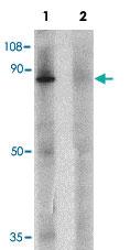 Anti-ZFX Rabbit Polyclonal Antibody