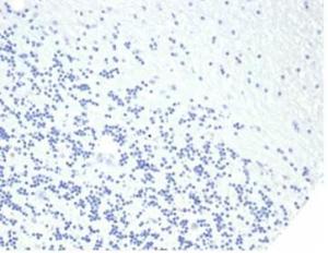 Negative Tissue Control: Immunohistochemical analysis of formalin-fixed, paraffin-embedded human brain using Anti-Growth Hormone Antibody [rGH/4887] at 2µg/ml in PBS for 30 minutes at room temperature