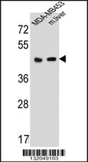 Anti-HTR4 Rabbit Polyclonal Antibody