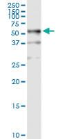 Anti-TUBB Polyclonal Antibody Pair