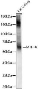 Anti-EAAT2 antibody