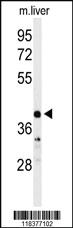 Anti-CA5B Rabbit Polyclonal Antibody