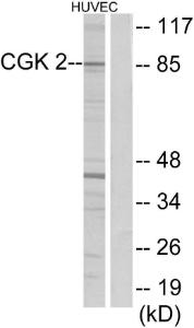 Western blot analysis of lysates from HUVEC cells using Anti-CGK 2 Antibody. The right hand lane represents a negative control, where the Antibody is blocked by the immunising peptide