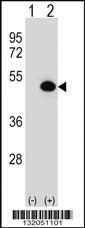 Anti-ASS1 Rabbit Polyclonal Antibody