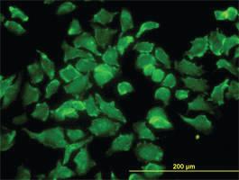 Anti-BPNT1 Mouse Monoclonal Antibody [clone: 2E1]