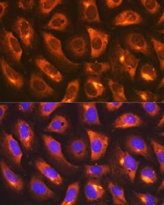 Immunofluorescence analysis of U-2 OS cells using Anti-IMPDH2 Antibody [ARC1479] (A308284) at a dilution of 1:100 (40X lens). DAPI was used to stain the cell nuclei (blue)