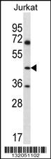 Anti-ASS1 Rabbit Polyclonal Antibody