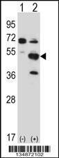 Anti-PXK Rabbit Polyclonal Antibody (APC (Allophycocyanin))