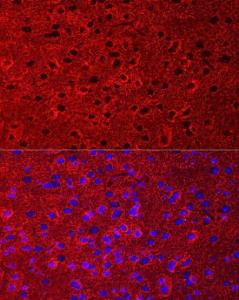 Anti-EAAT2 antibody