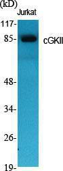 Western blot analysis of various cells using Anti-CGK 2 Antibody