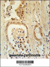 Anti-ZNF385B Rabbit Polyclonal Antibody