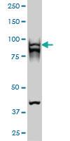 Anti-RAD54B Mouse Monoclonal Antibody [clone: 4A7]