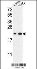 Anti-ABHD14B Rabbit Polyclonal Antibody (APC (Allophycocyanin))