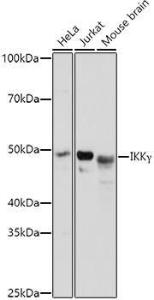 Anti-IKK gamma / NEMO Rabbit Polyclonal Antibody