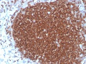 Immunohistochemical analysis of formalin-fixed, paraffin-embedded human lymph node using Anti-CD19 Antibody [rCD19/4591]