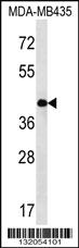 Anti-SERPINE2 Rabbit Polyclonal Antibody