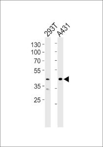 Anti-CSNK2A1 Rabbit Polyclonal Antibody