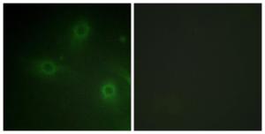 Immunofluorescence analysis of HeLa cells using Anti-p47 phox Antibody. The right hand panel represents a negative control, where the antibody was pre-incubated with the immunising peptide.