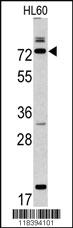 Anti-CAPN9 Rabbit Polyclonal Antibody