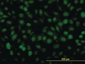 Anti-RAD54B Mouse Monoclonal Antibody [clone: 4A7]