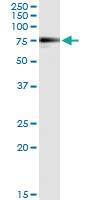 Anti-MGAT3 Antibody Pair