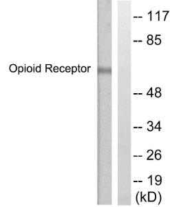 Western blot analysis of lysates from COS7 cells using Anti-CCR5 Antibody. The right hand lane represents a negative control, where the antibody is blocked by the immunising peptide