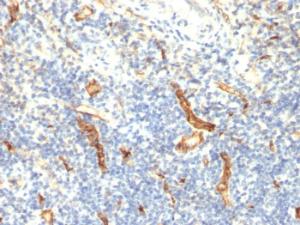 Immunohistochemical analysis of formalin-fixed, paraffin-embedded human tonsil using Anti-CD34 Antibody [HPCA1/1171]