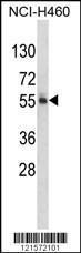 Anti-FTO Rabbit Polyclonal Antibody (PE (Phycoerythrin))