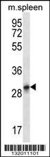 Anti-KRT222 Rabbit Polyclonal Antibody (HRP (Horseradish Peroxidase))