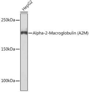 Anti-alpha 2 Macroglobulin Rabbit Monoclonal Antibody [clone: ARC1734]