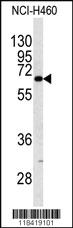 Anti-KRT9 Rabbit Polyclonal Antibody