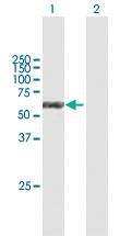 Anti-CK6B Mouse Polyclonal Antibody