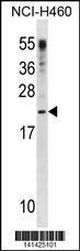 Anti-CSF3 Rabbit Polyclonal Antibody (Biotin)