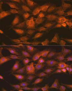 Anti-IKK gamma / NEMO Rabbit Polyclonal Antibody