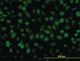 Anti-RAD54B Mouse Monoclonal Antibody [clone: 4A7]