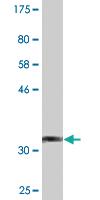 Anti-PKHD1L1 Mouse Monoclonal Antibody [clone: 1F5]