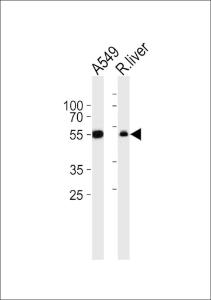 Anti-ALDH1A1 Rabbit Polyclonal Antibody