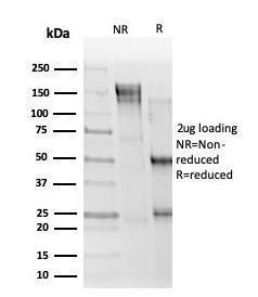 SDS-PAGE analysis of Anti-ELK1 Antibody [PCRP-ELK1-1B9] under non-reduced and reduced conditions; showing intact IgG and intact heavy and light chains, respectively. SDS-PAGE analysis confirms the integrity and purity of the antibody