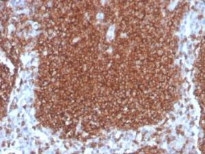 Immunohistochemical analysis of formalin-fixed, paraffin-embedded human lymph node using Anti-CD19 Antibody [rCD19/4591]