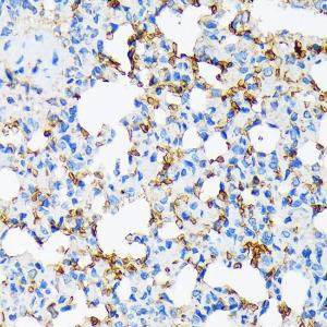 Anti-alpha 2 Macroglobulin Rabbit Monoclonal Antibody [clone: ARC1734]