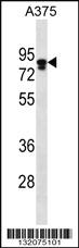 Anti-MLPH Rabbit Polyclonal Antibody