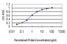 Anti-RAD54B Mouse Monoclonal Antibody [clone: 4A7]