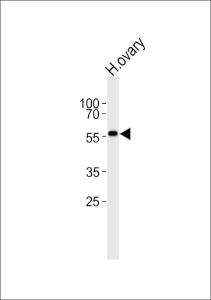 Anti-MPP7 Rabbit Polyclonal Antibody