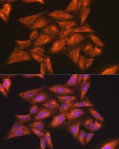 Anti-IKK gamma / NEMO Rabbit Polyclonal Antibody