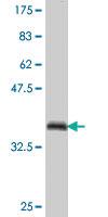 Anti-ZNF131 Mouse Polyclonal Antibody