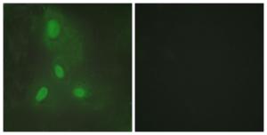 Immunofluorescence analysis of HeLa cells using Anti-BACH1 Antibody The right hand panel represents a negative control, where the antibody was pre-incubated with the immunising peptide