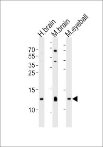 Anti-HBG2 Rabbit Polyclonal Antibody