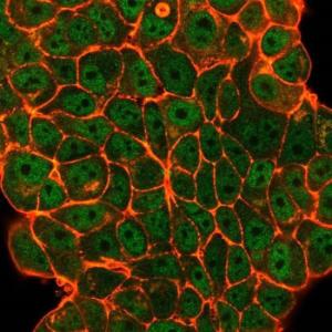 Antibody anti-ELK1 pcrp-ELK1-1D9 100 µg